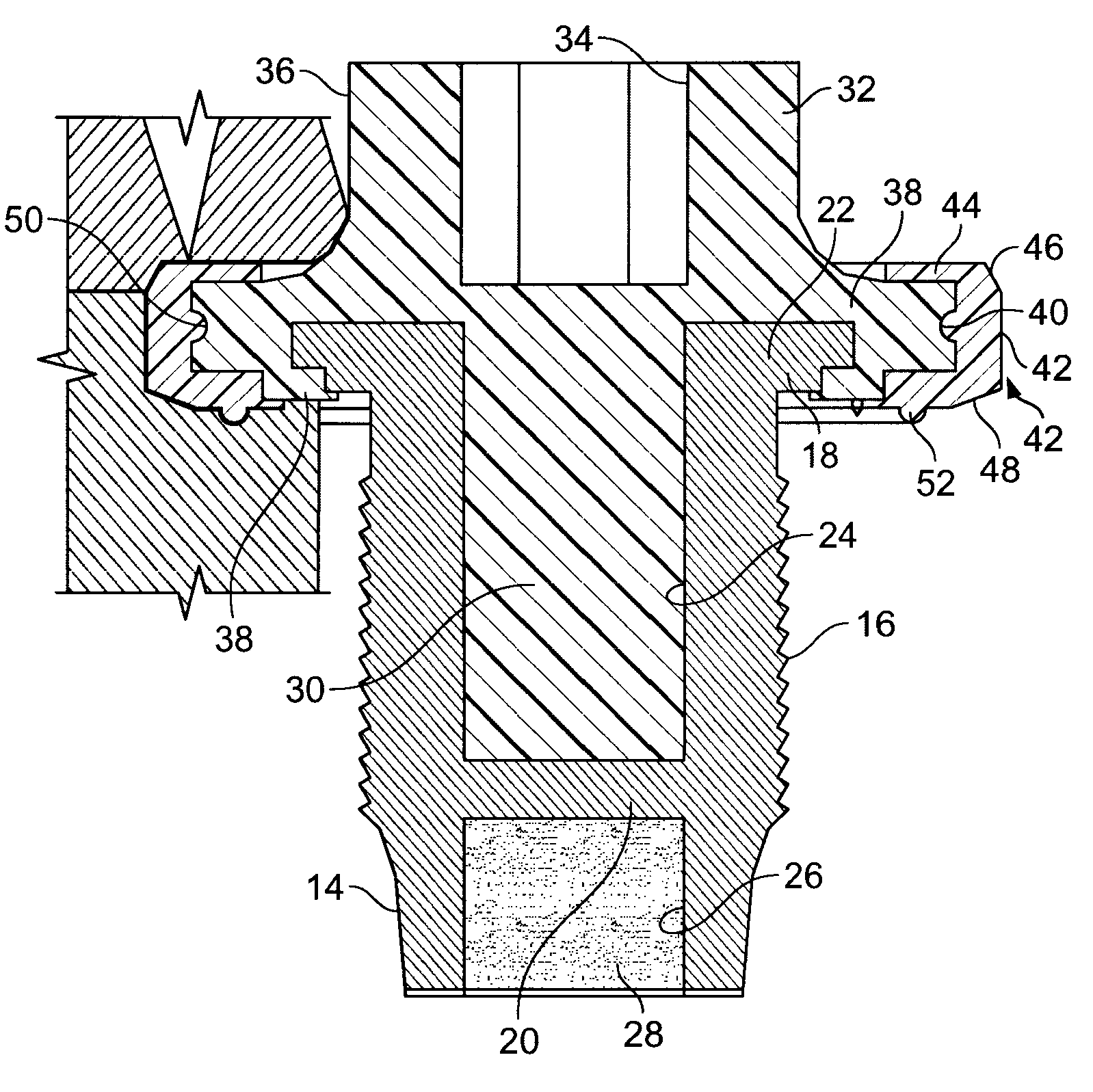 Composite drain plug