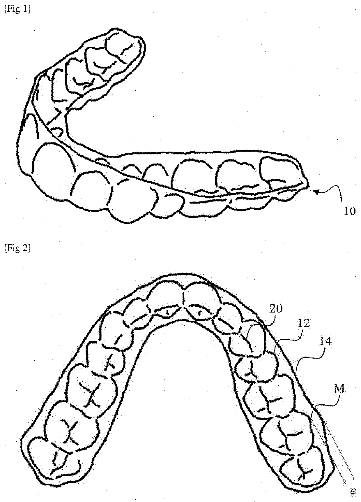 Method for evaluating an orthodontic aligner