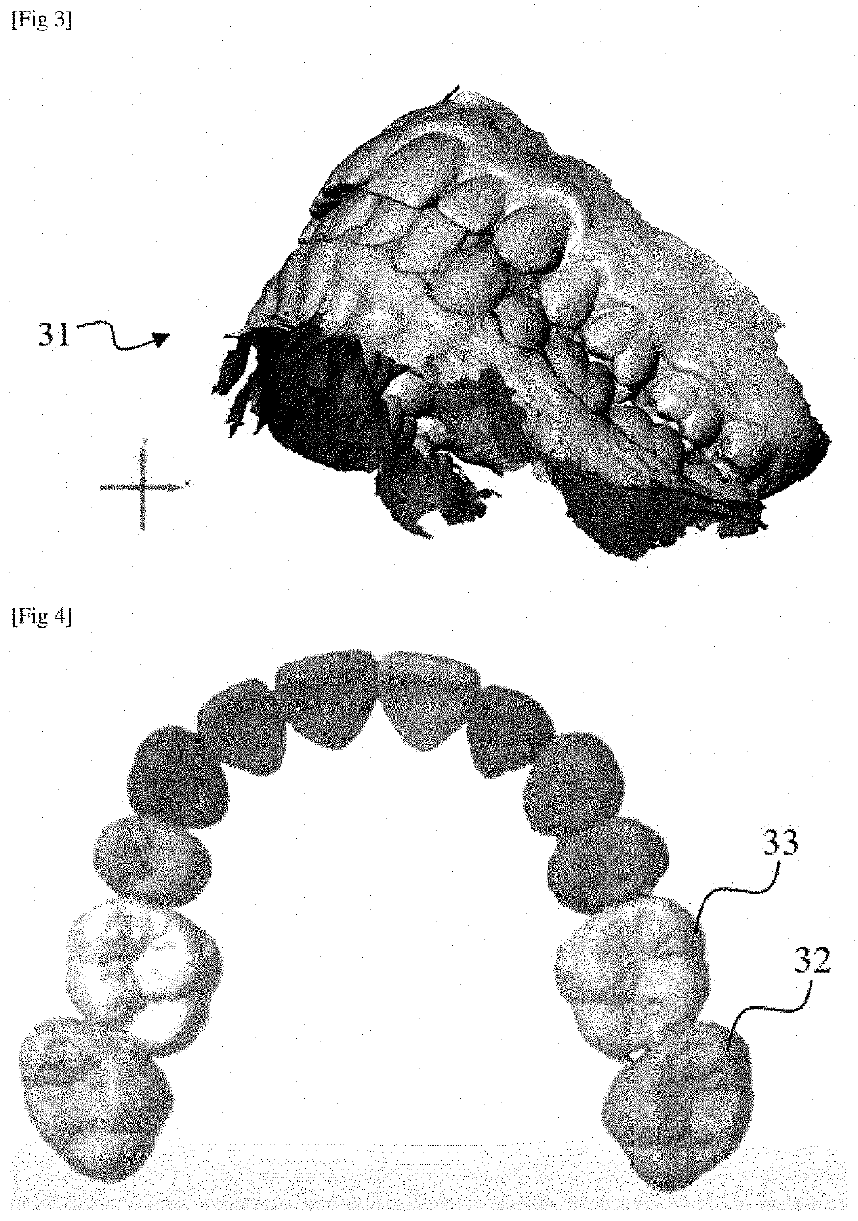 Method for evaluating an orthodontic aligner