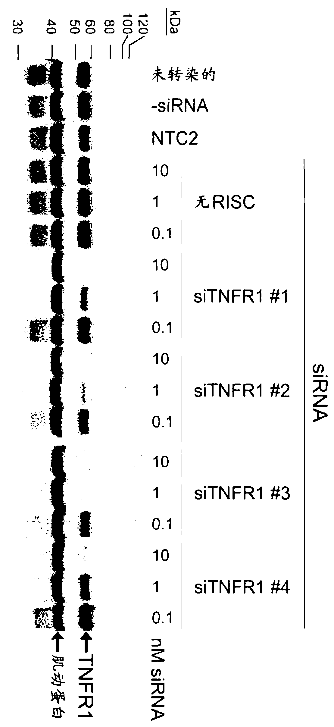 RNAi-mediated inhibition of tumor necrosis factor alpha-related conditions