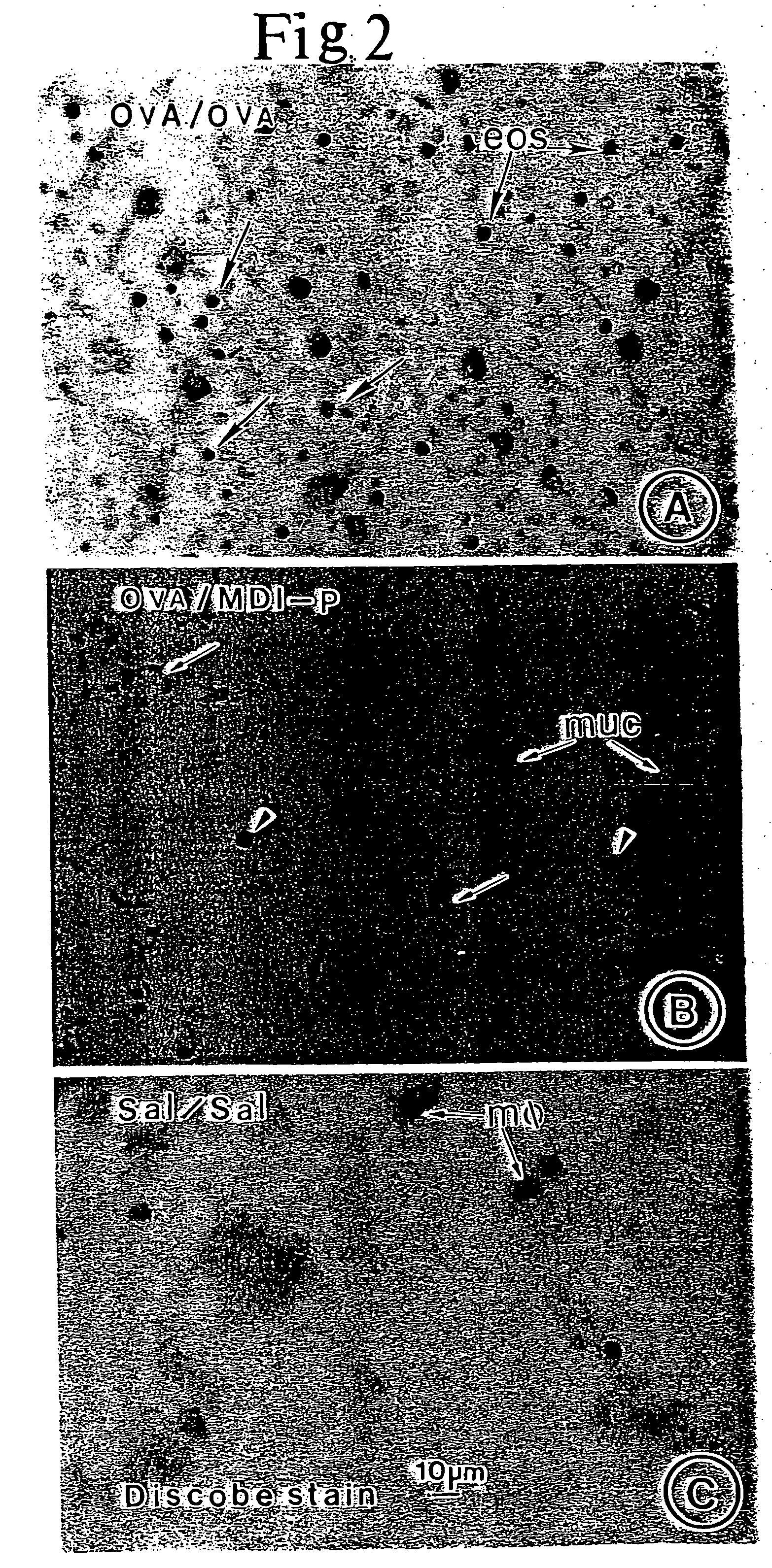 Method of treating respiratory disorders and airway inflammation