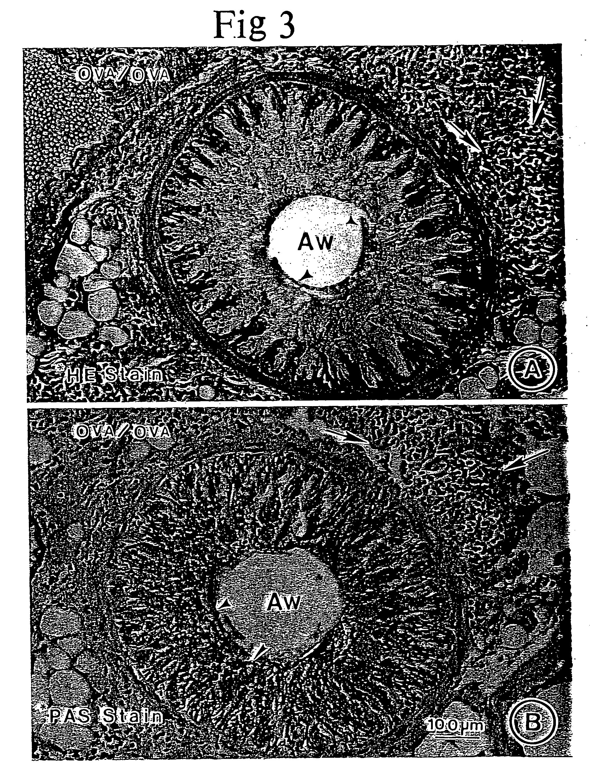 Method of treating respiratory disorders and airway inflammation