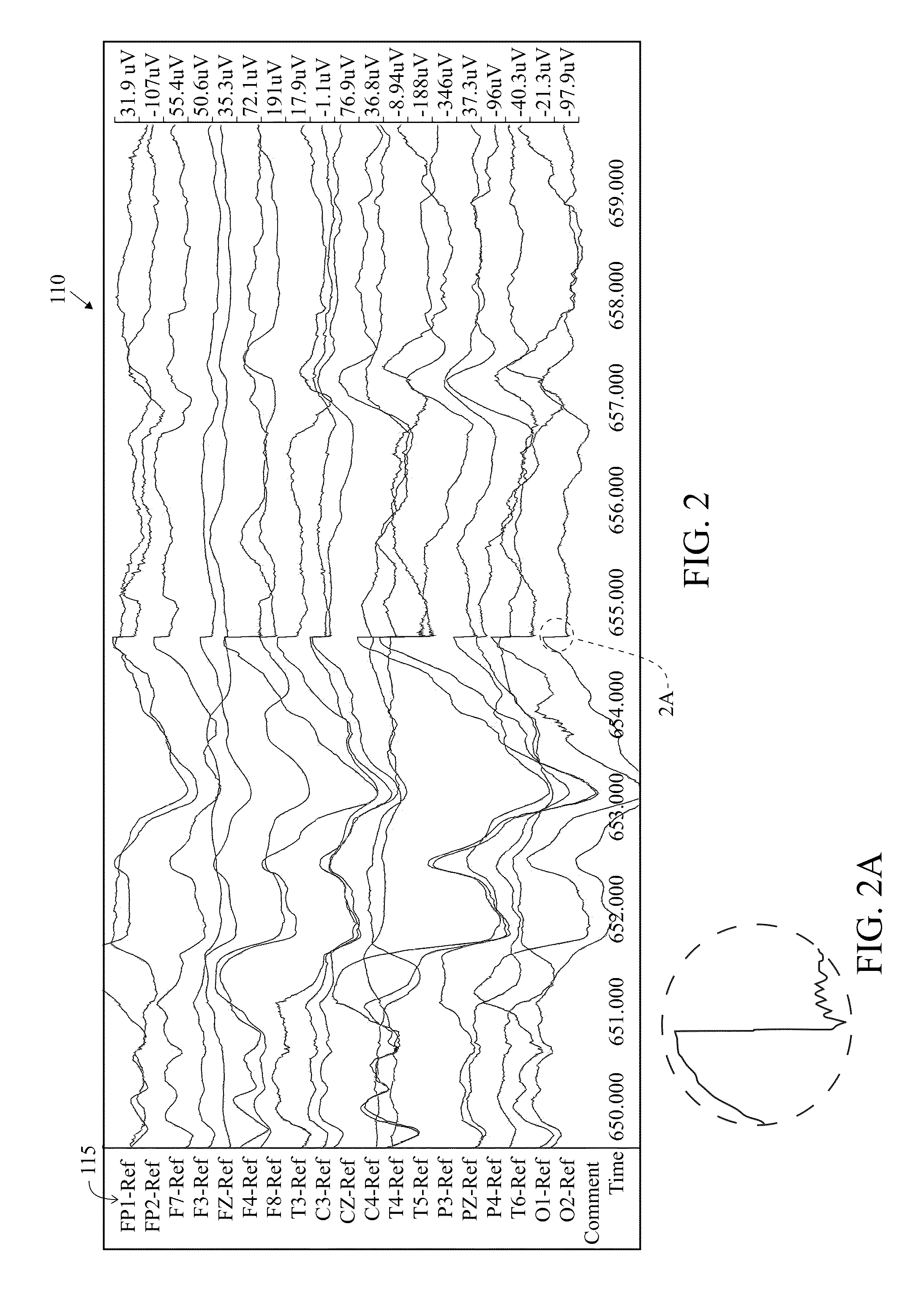 User Interface For Artifact Removal In An EEG