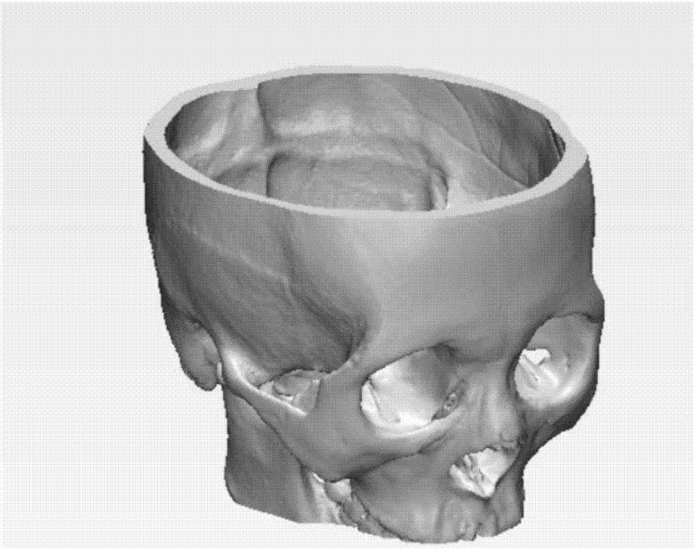 Orbital blow-out fracture titanium mesh prefabrication method