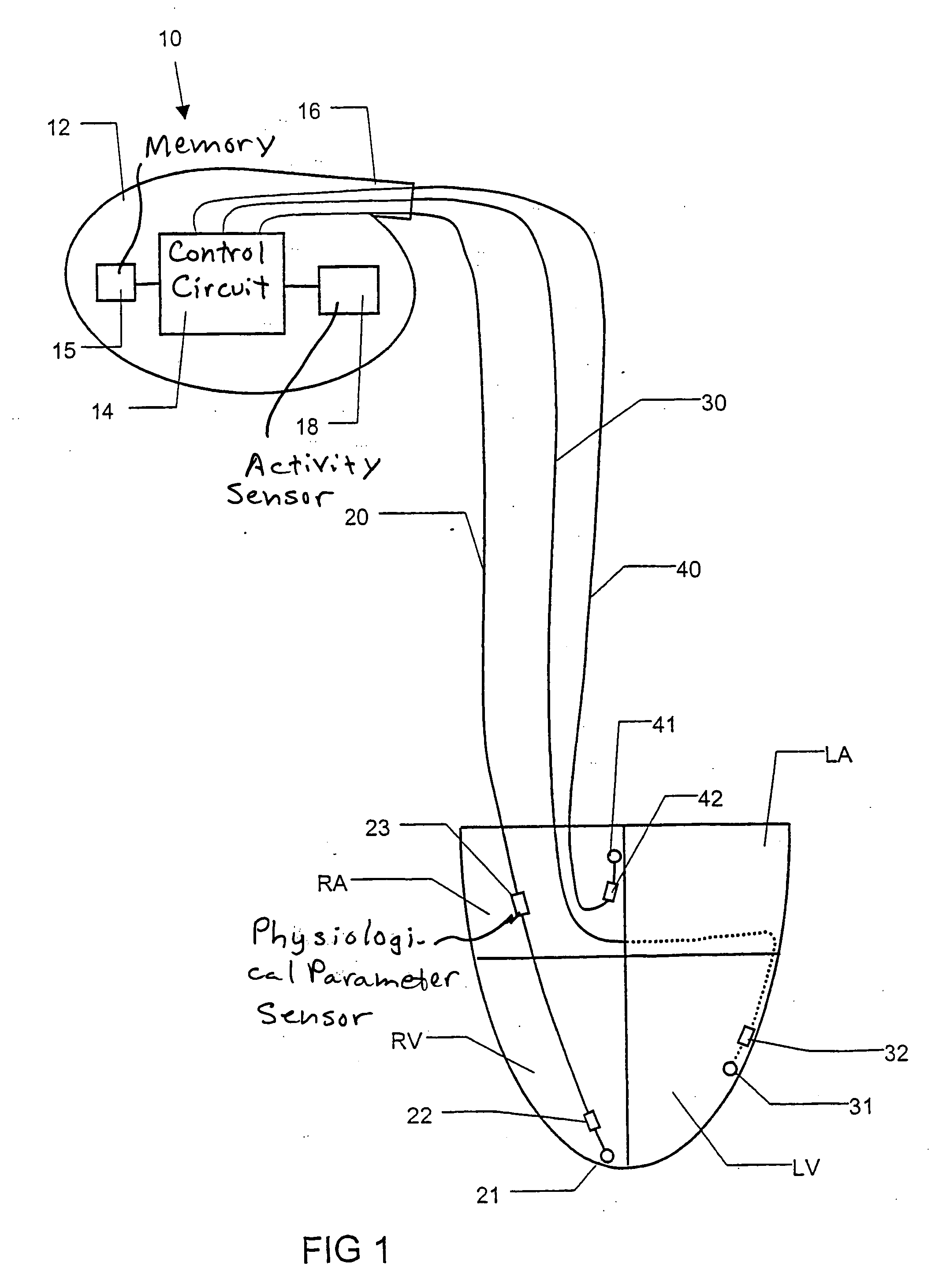 Heart monitoring and stimulating device, a system including such a device and use of the system