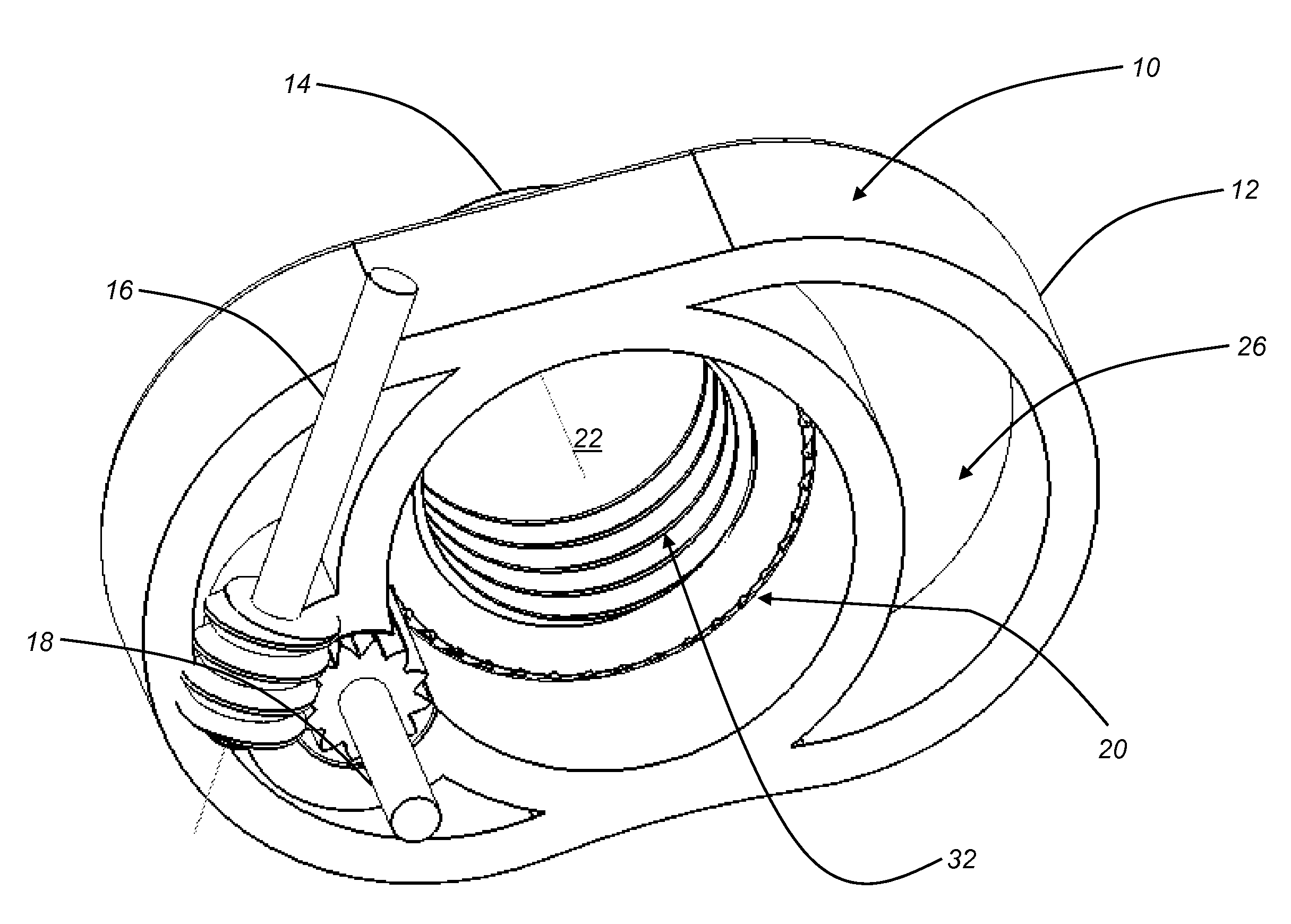 Anterior lumbar interbody fusion cage device and associated method