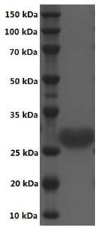 A short-chain dehydrogenase and its gene, recombinant expression vector, genetically engineered bacteria and its application in the synthesis of astaxanthin chiral intermediates