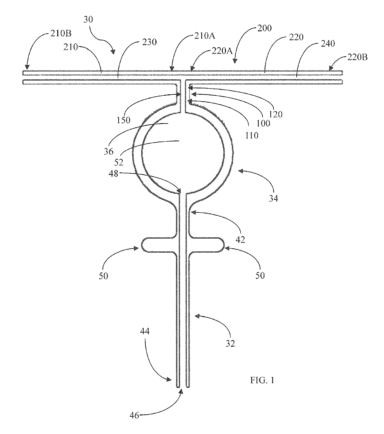 Method and apparatus for reducing intraocular pressure