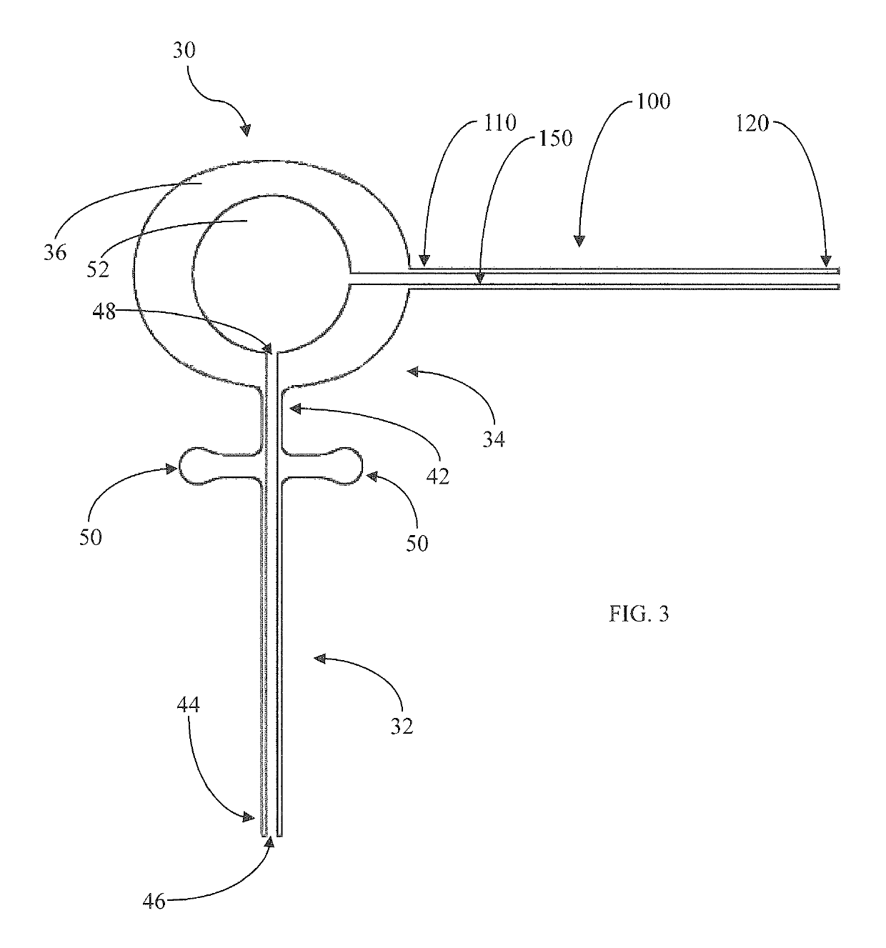 Method and apparatus for reducing intraocular pressure