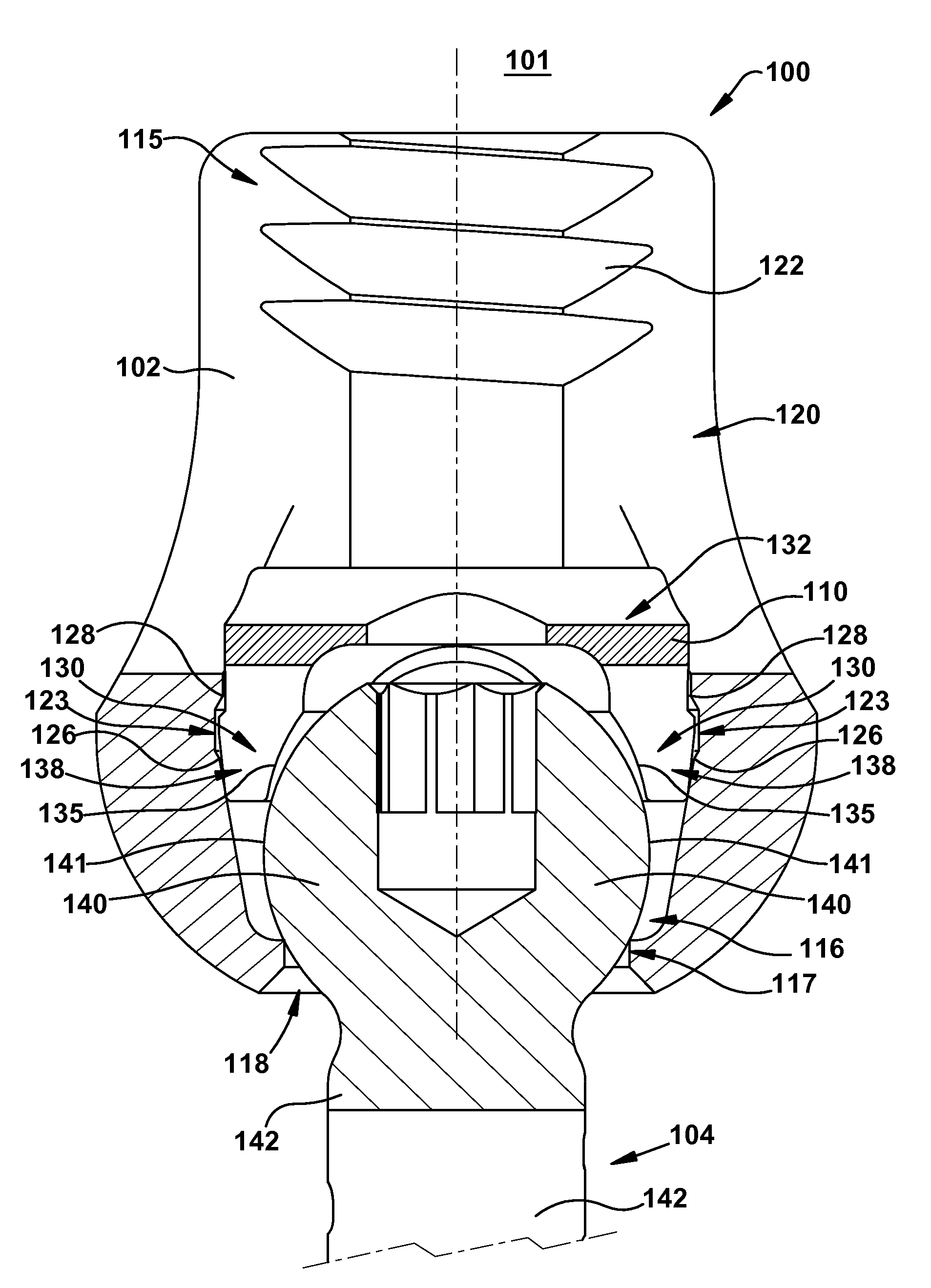 Spinal fixation assembly with intermediate element