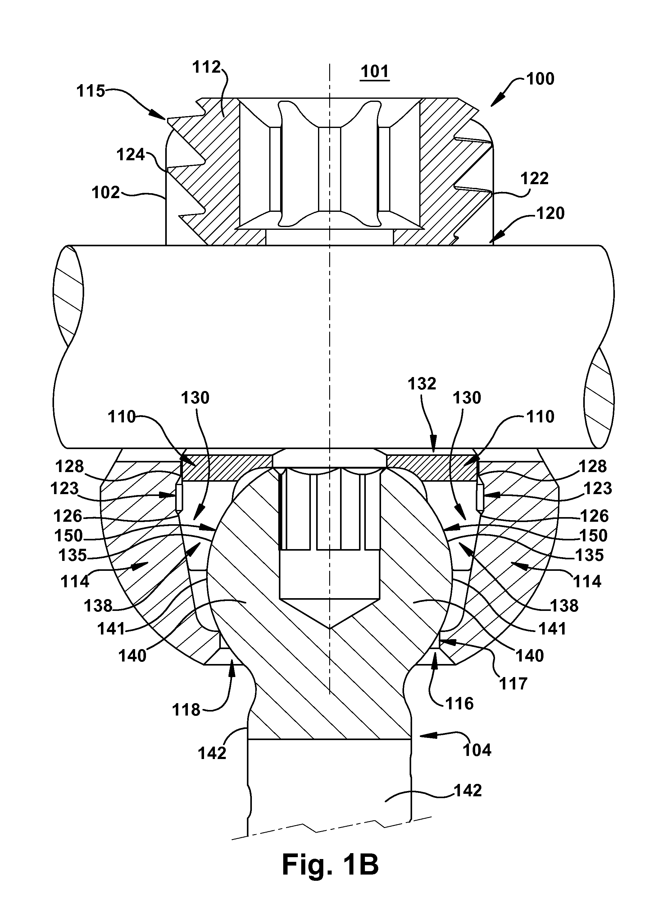 Spinal fixation assembly with intermediate element