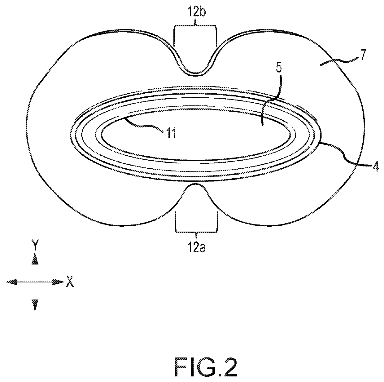 Oral and nasal devices for the treatment of sleep apnea and/or snoring with filter and sensors to provide remote digital monitoring and remote data analysis