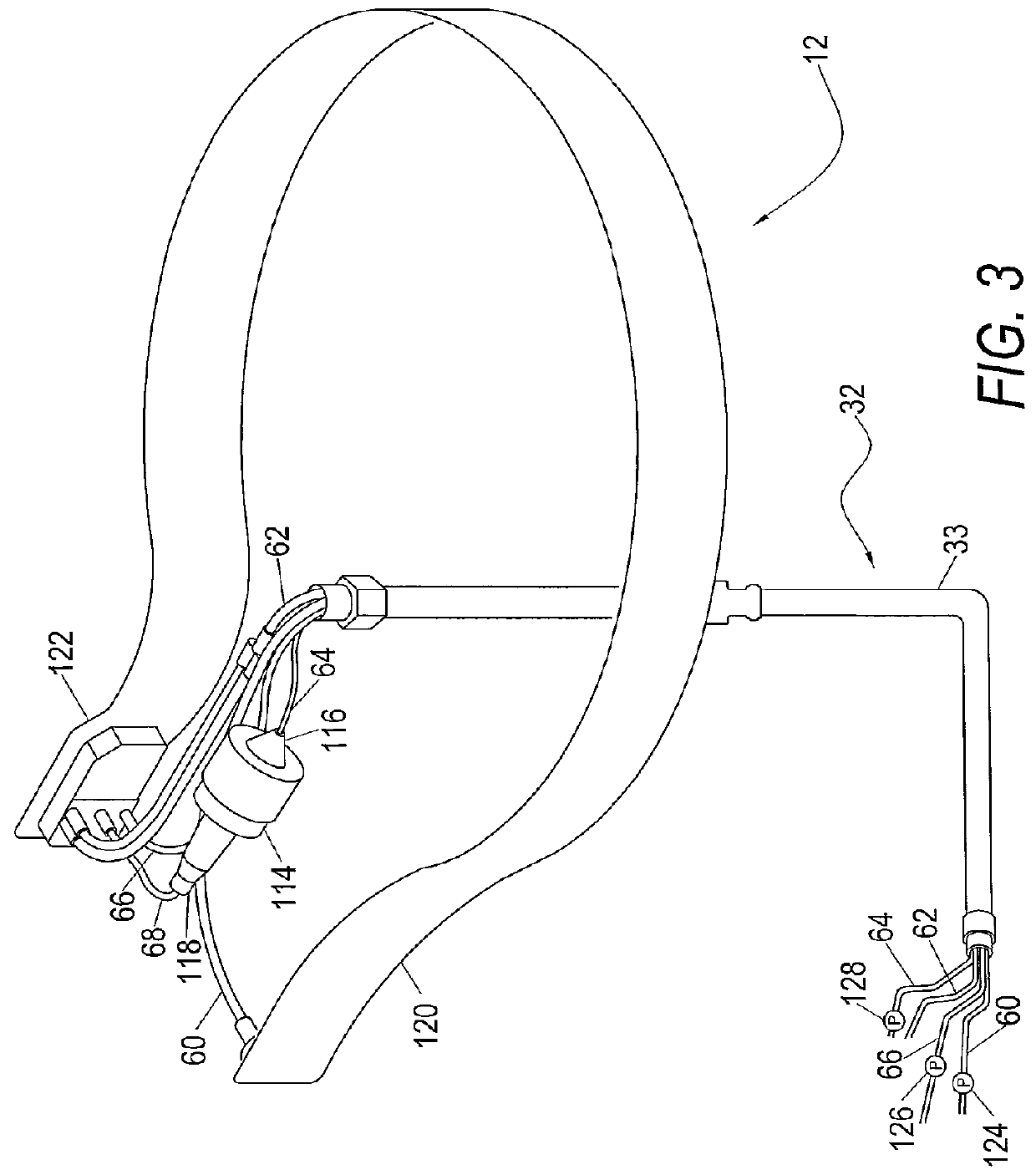 System for blood separation with a separation chamber having an internal gravity valve