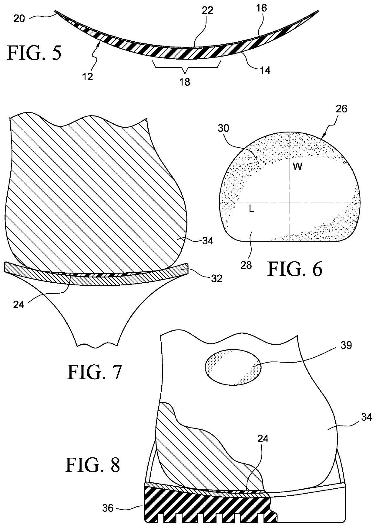 Foot prosthetic