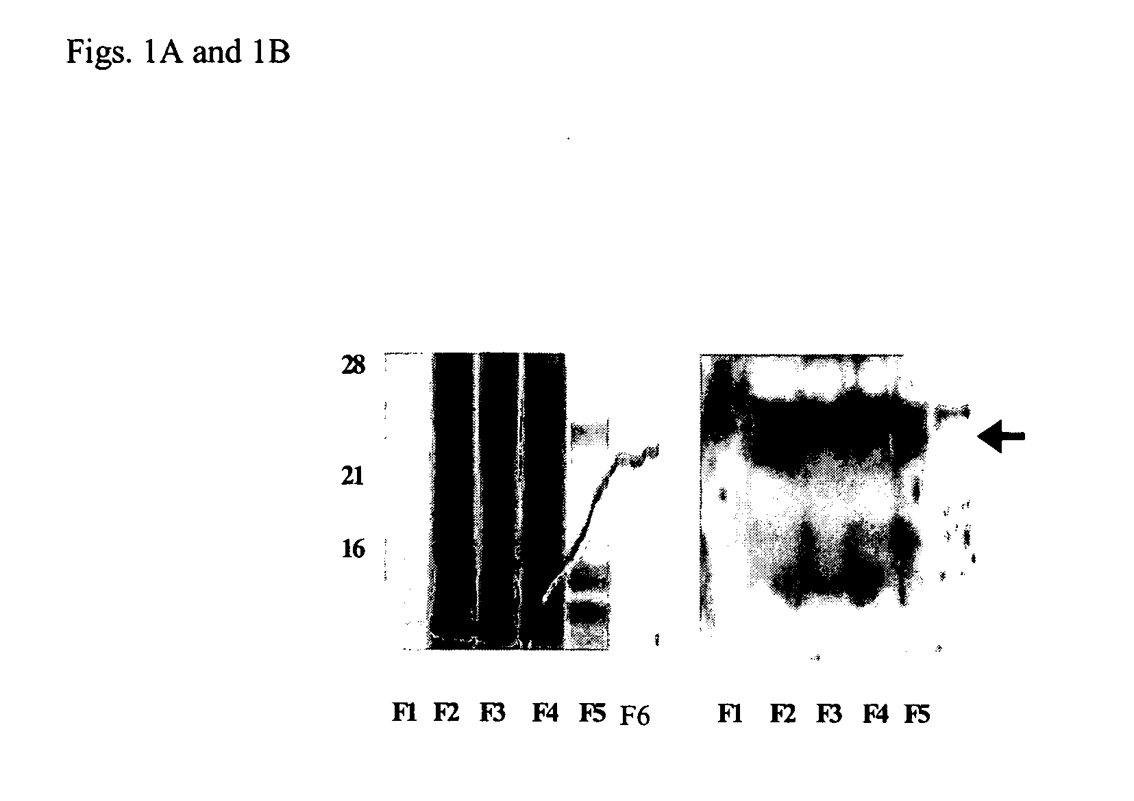 Agonist polypeptide of receptor for Zot and Zonulin