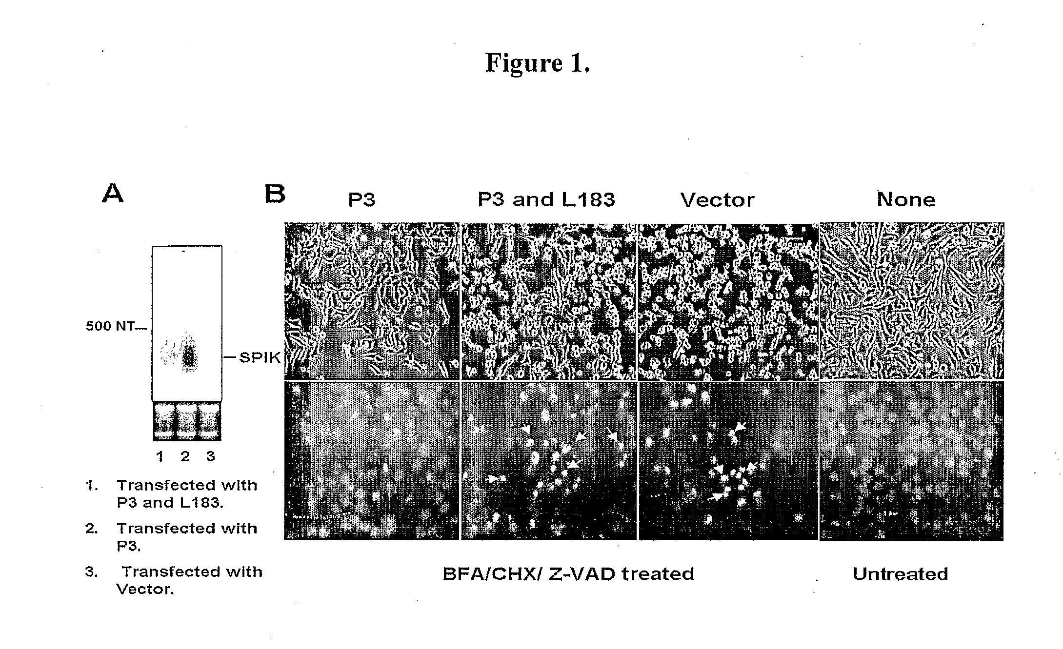 Identification of modulators of serine protease inhibitor kazal and their use as Anti-cancer and Anti-viral agents