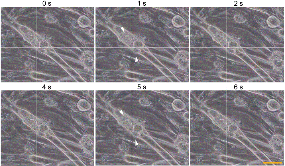 Method for obtaining spinal motoneurons and functional cells thereof based on human iPS (induced pluripotent stem) cells