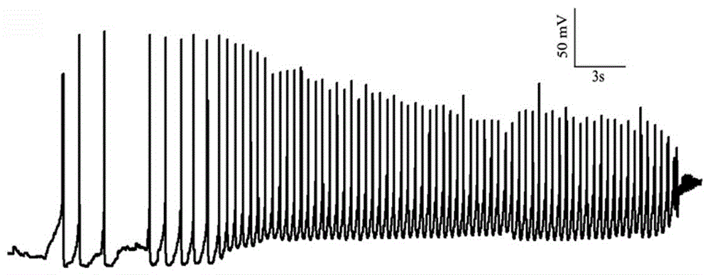 Method for obtaining spinal motoneurons and functional cells thereof based on human iPS (induced pluripotent stem) cells