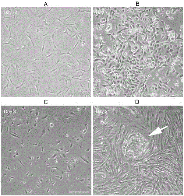 Method for obtaining spinal motoneurons and functional cells thereof based on human iPS (induced pluripotent stem) cells