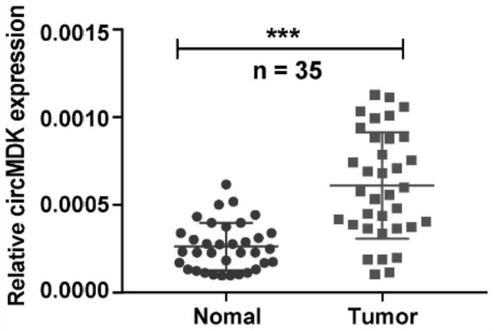 Cyclic RNAcircMDK, application thereof and liver cancer treatment preparation