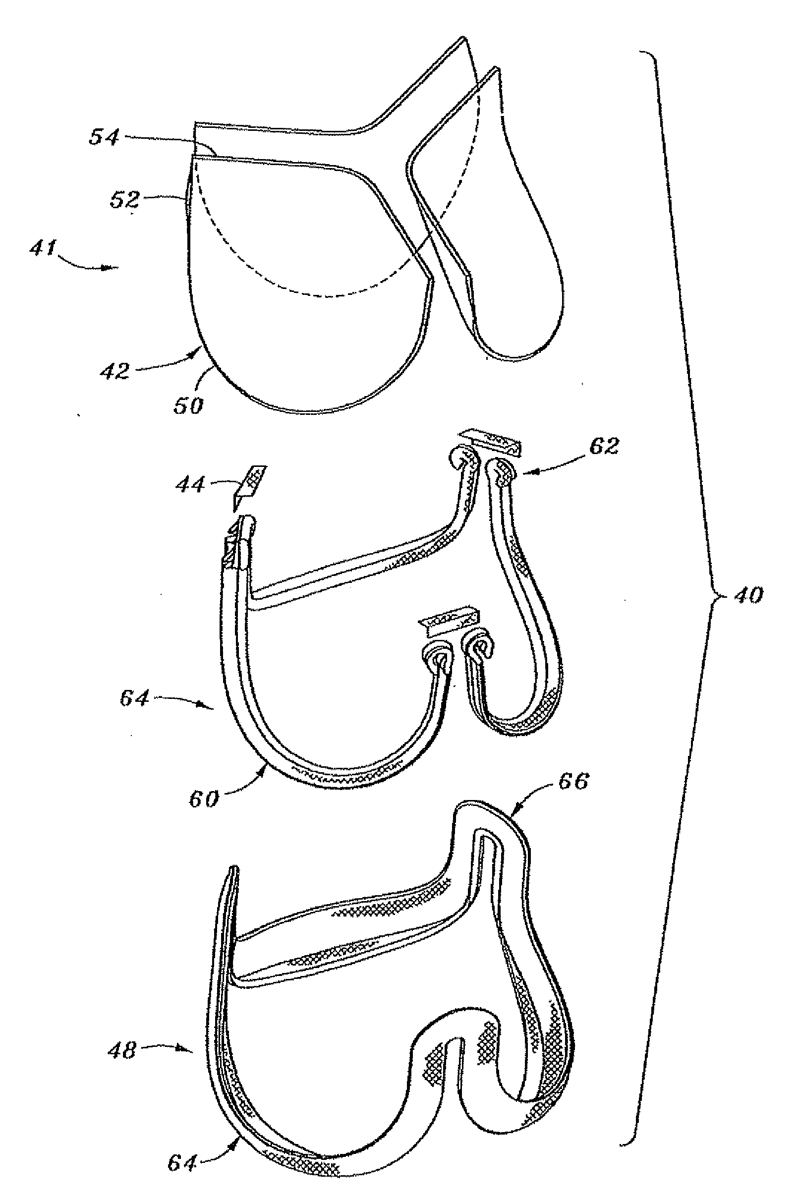 Flexible heart valve and associated connecting band