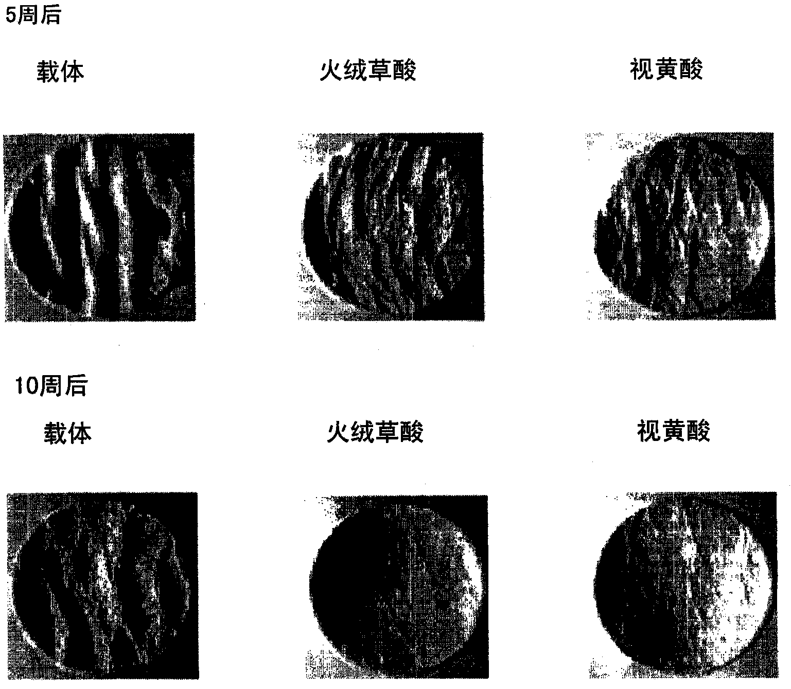 Anti-wrinkle cosmetic skin composition containing leontopodic acid as an active ingredient