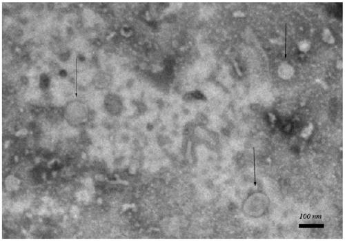 Embryo culture solution containing oviduct-derived exosome and embryo culture method