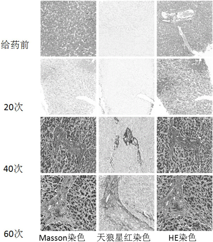 Method for establishing rhesus monkey hepatic fibrosis model by intragastric administration method