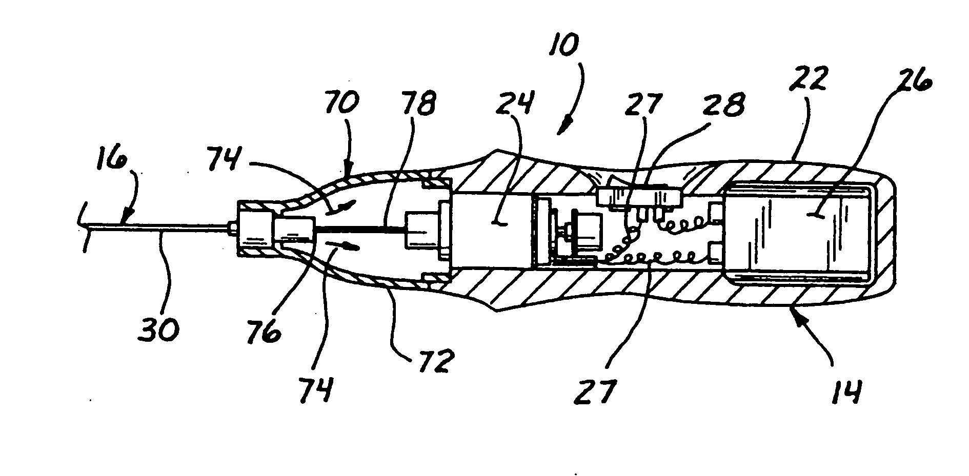 Micro-invasive device