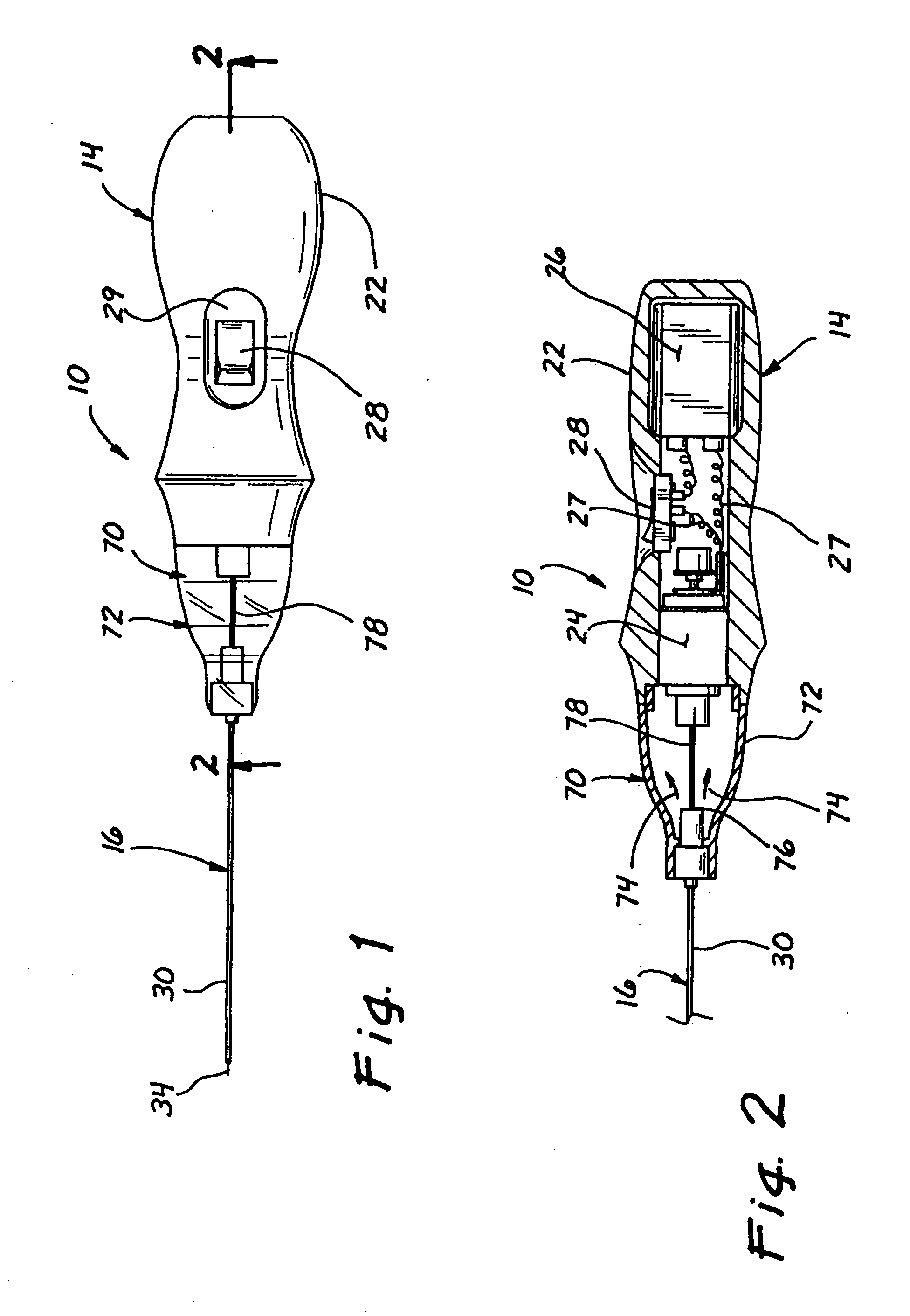 Micro-invasive device