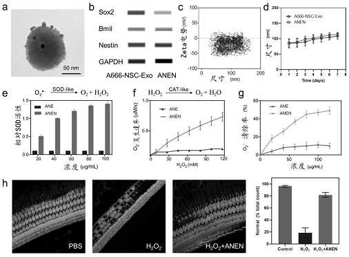 Delivery system of biomimetic modification of cerium oxide nanoparticles by exosomes and its application in hair cells