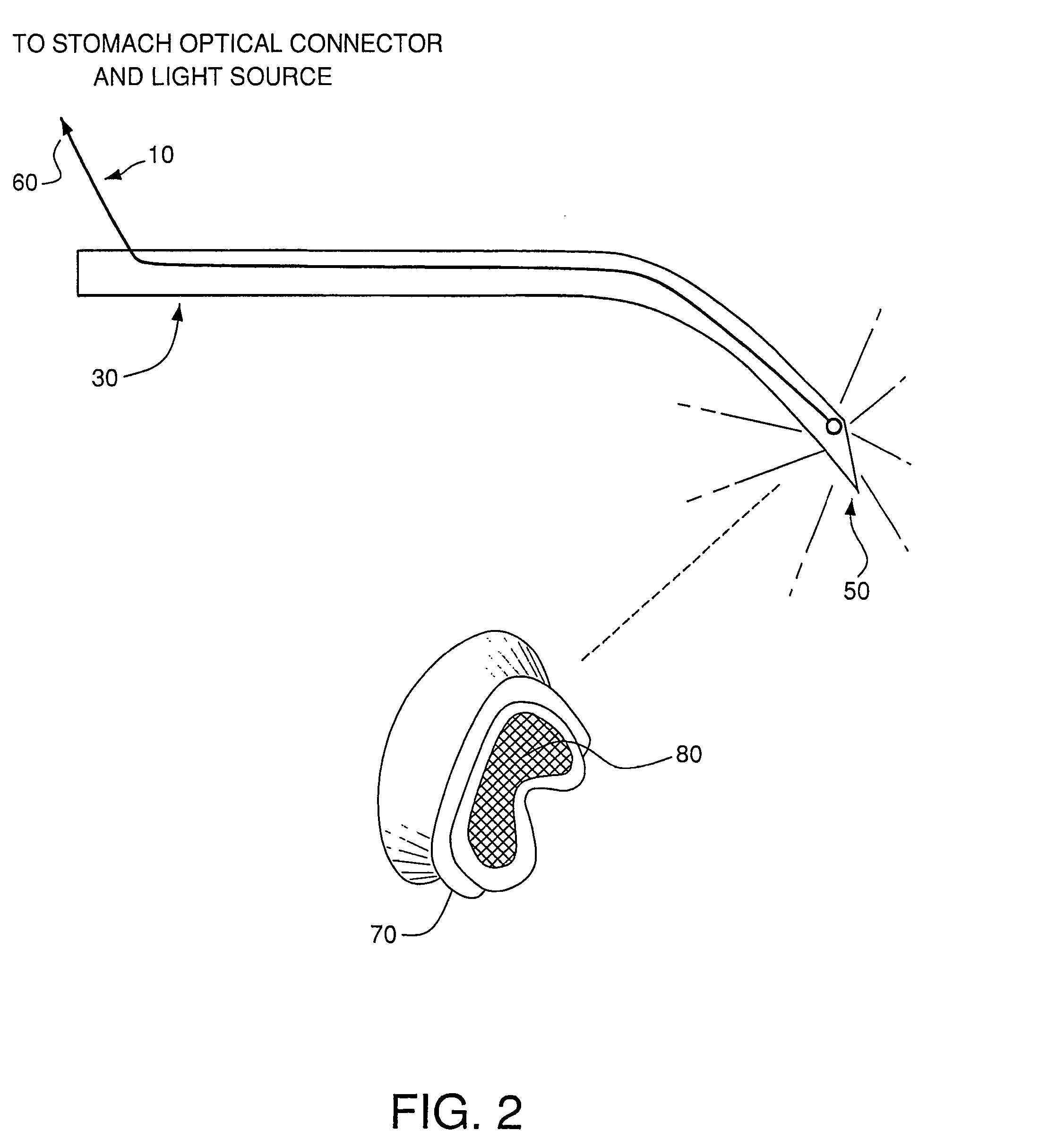 Optical guidance system for invasive catheter placement