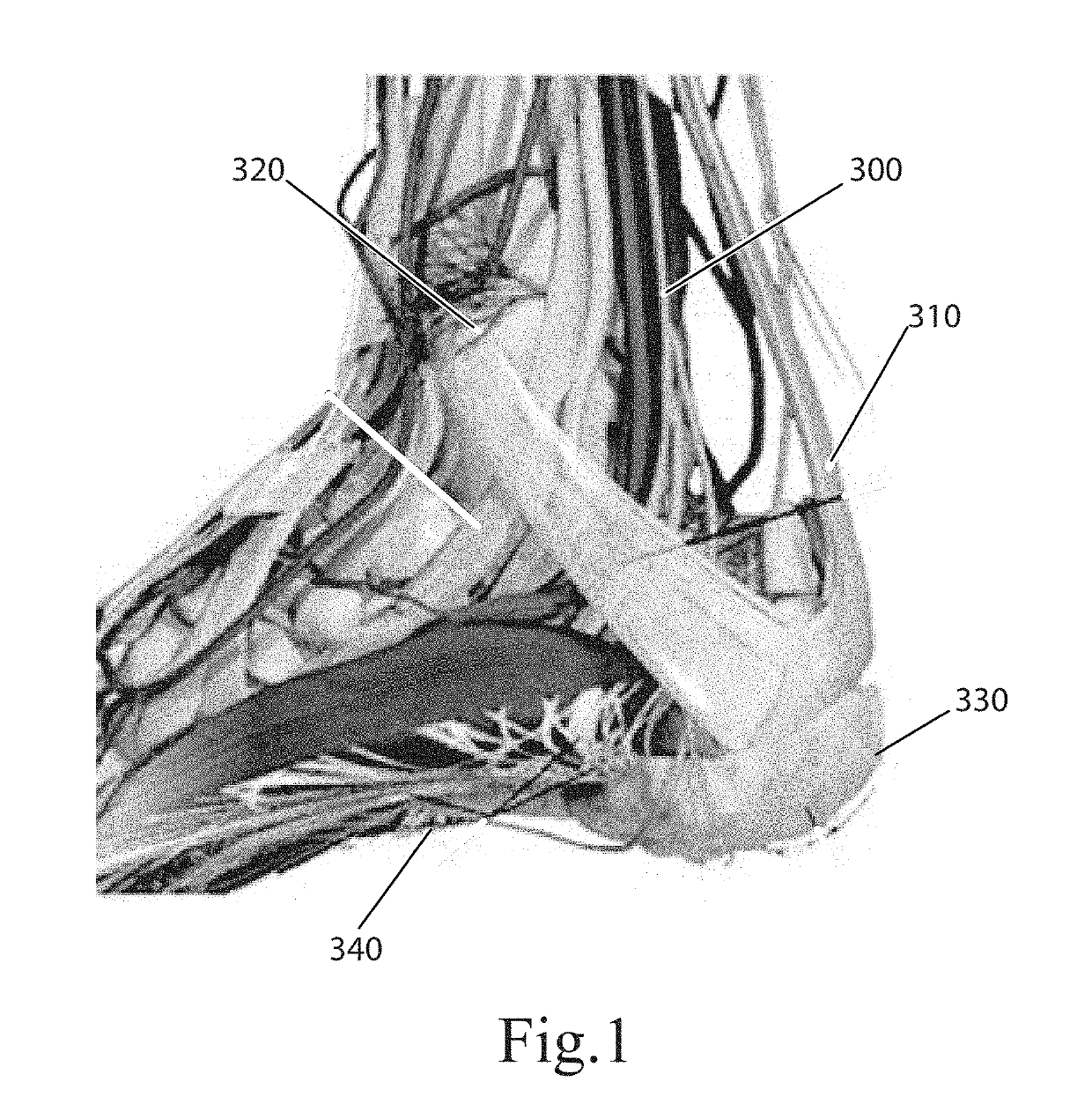 Topical nerve stimulation device