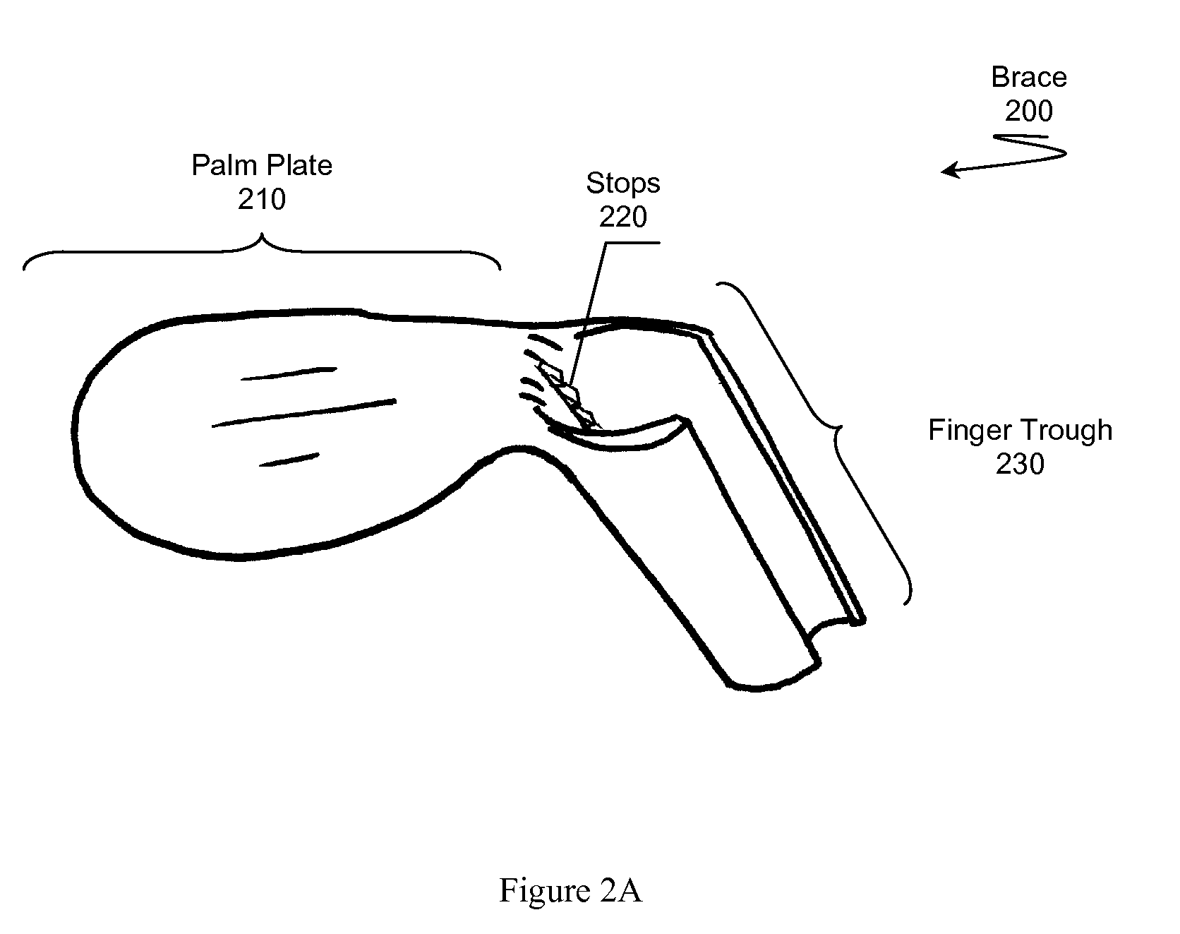 Brace for Reducing a Metacarpal Fracture