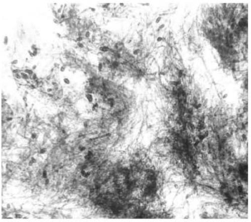 Method for stable germination of conidia of tomato gray leaf spot pathogens and for artificial inoculation identification in seedling stage