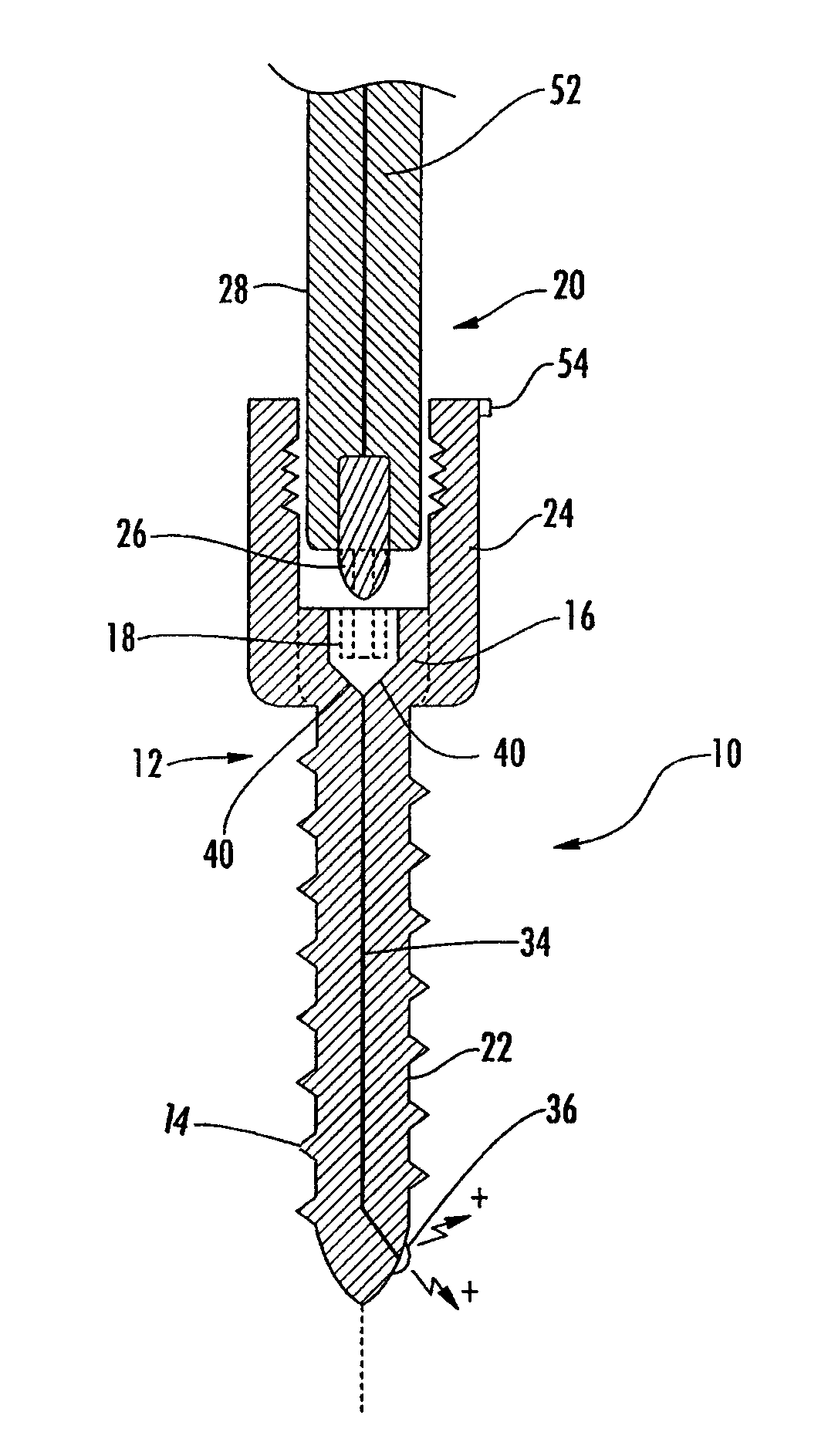 Implant equipped for nerve location and method of use