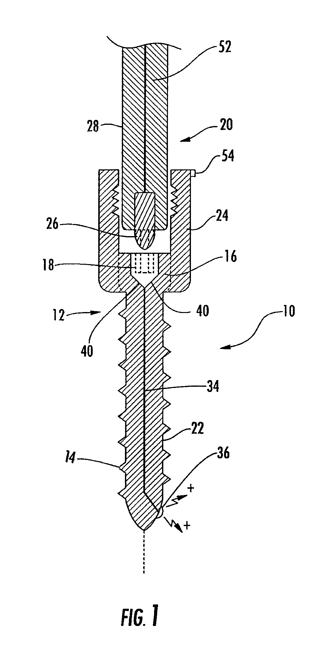 Implant equipped for nerve location and method of use