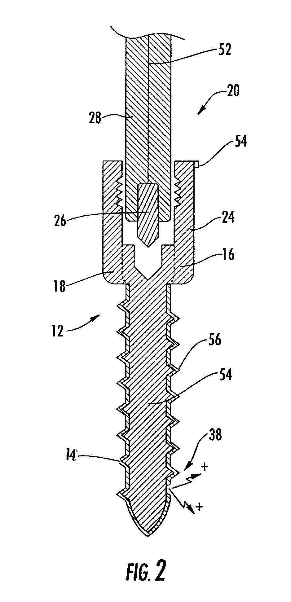 Implant equipped for nerve location and method of use