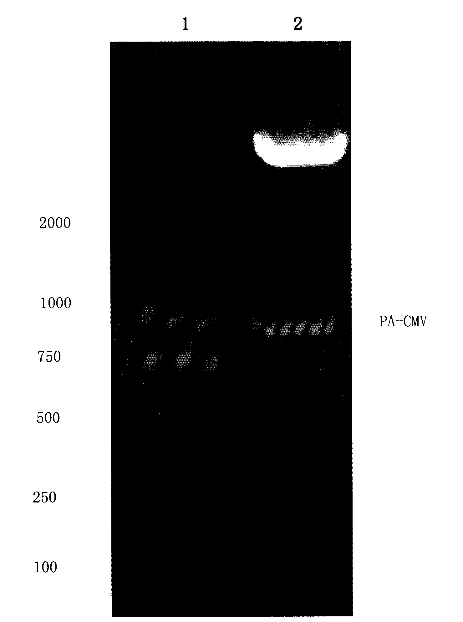 Adenovirus vector for gene therapy on hemophilia B and application thereof