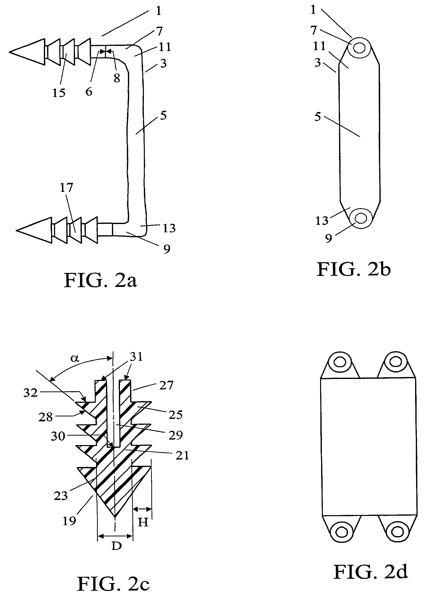 Intervertebral connection system