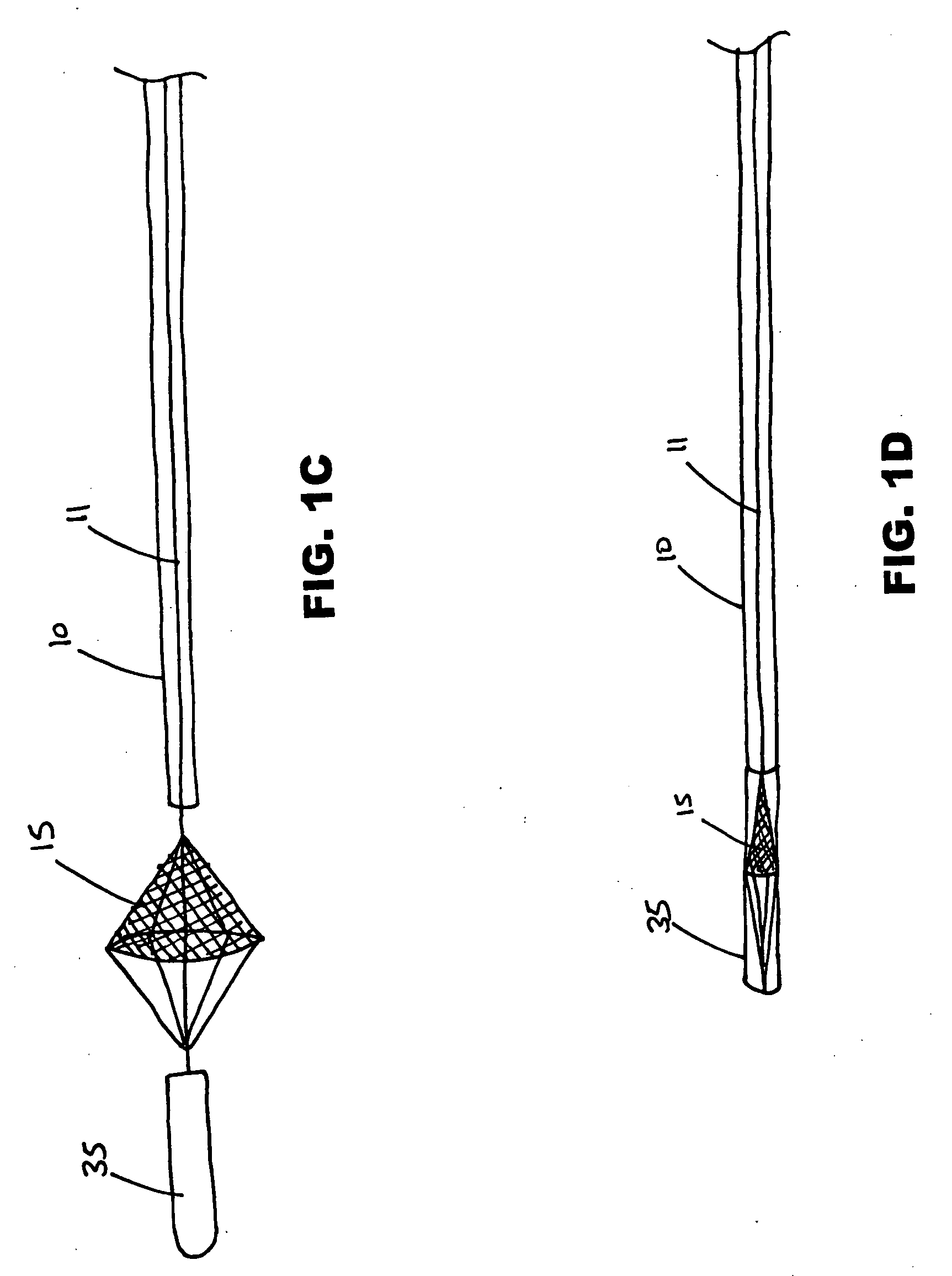 Distal filtration devices and methods of use during aortic procedures