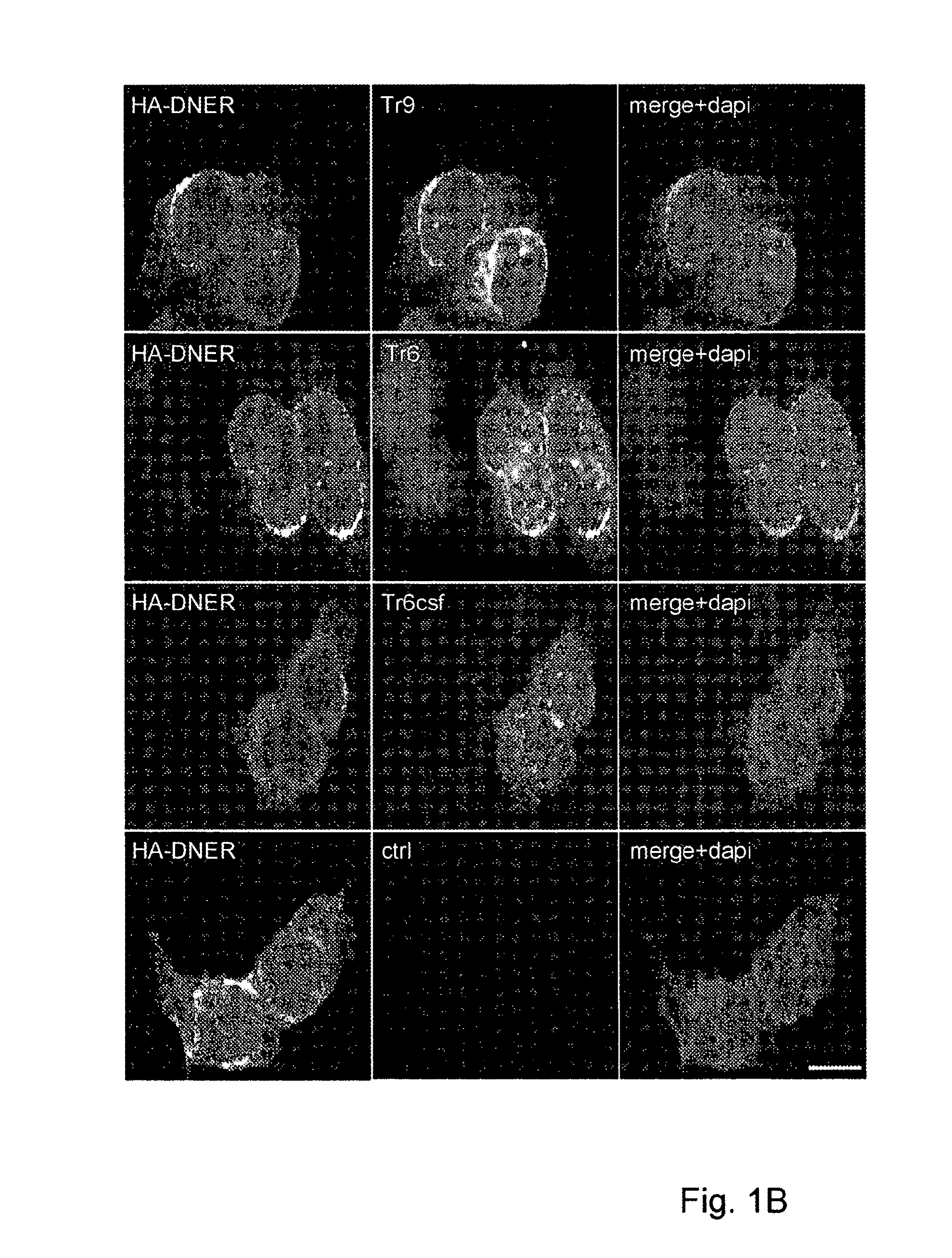 Assay for Anti-tr antibodies