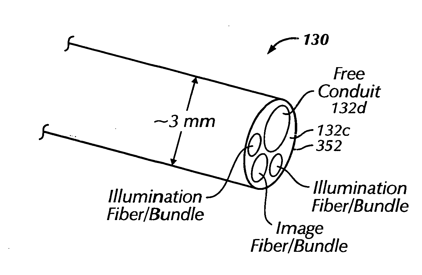 Ophthalmic orbital surgery apparatus and method and image-guided navigation system