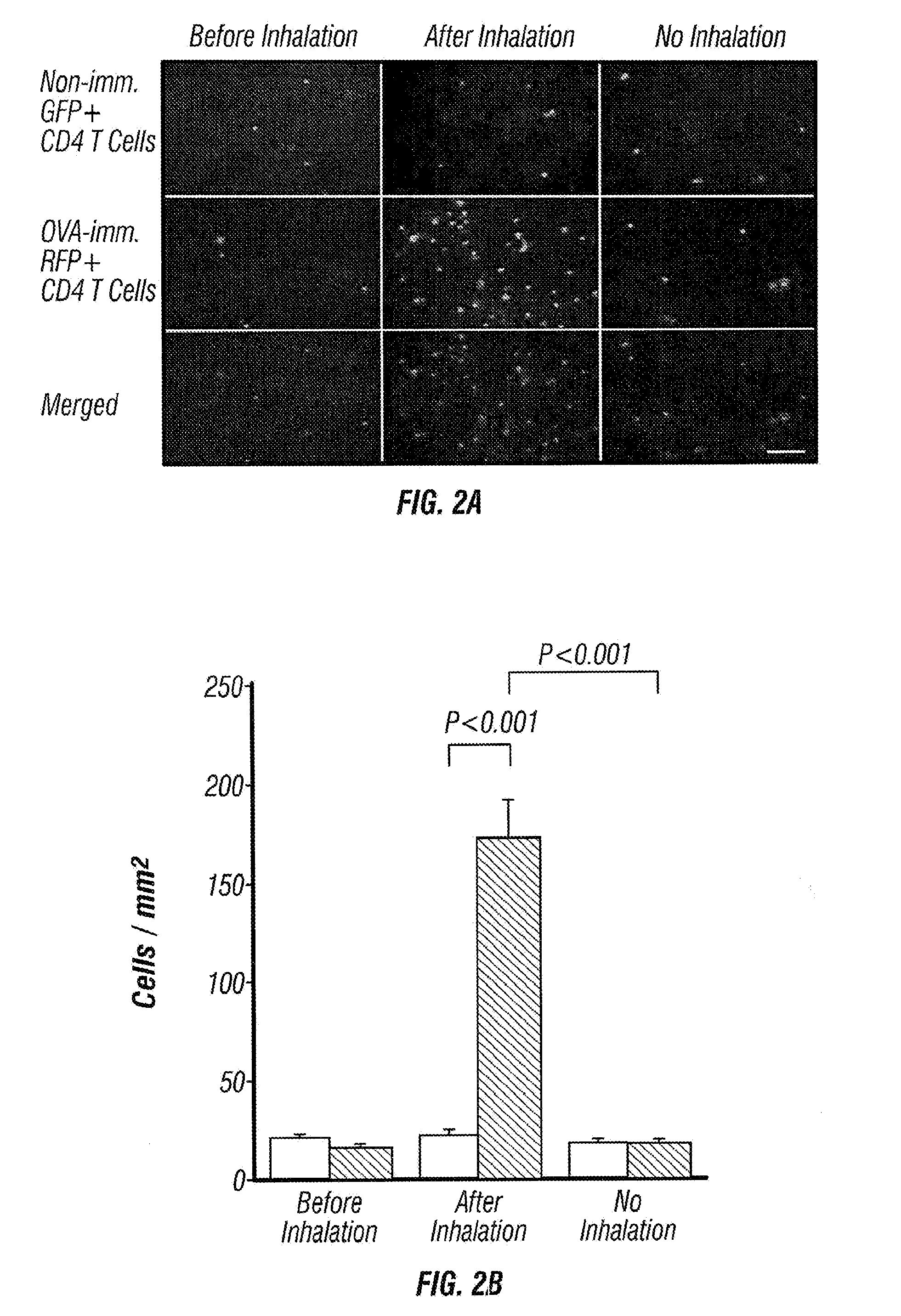 Imageable rodent model of asthma