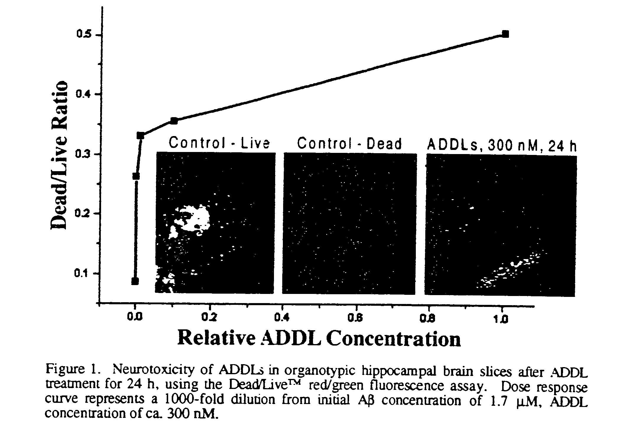 Amyloid beta protein (globular assembly and uses thereof)