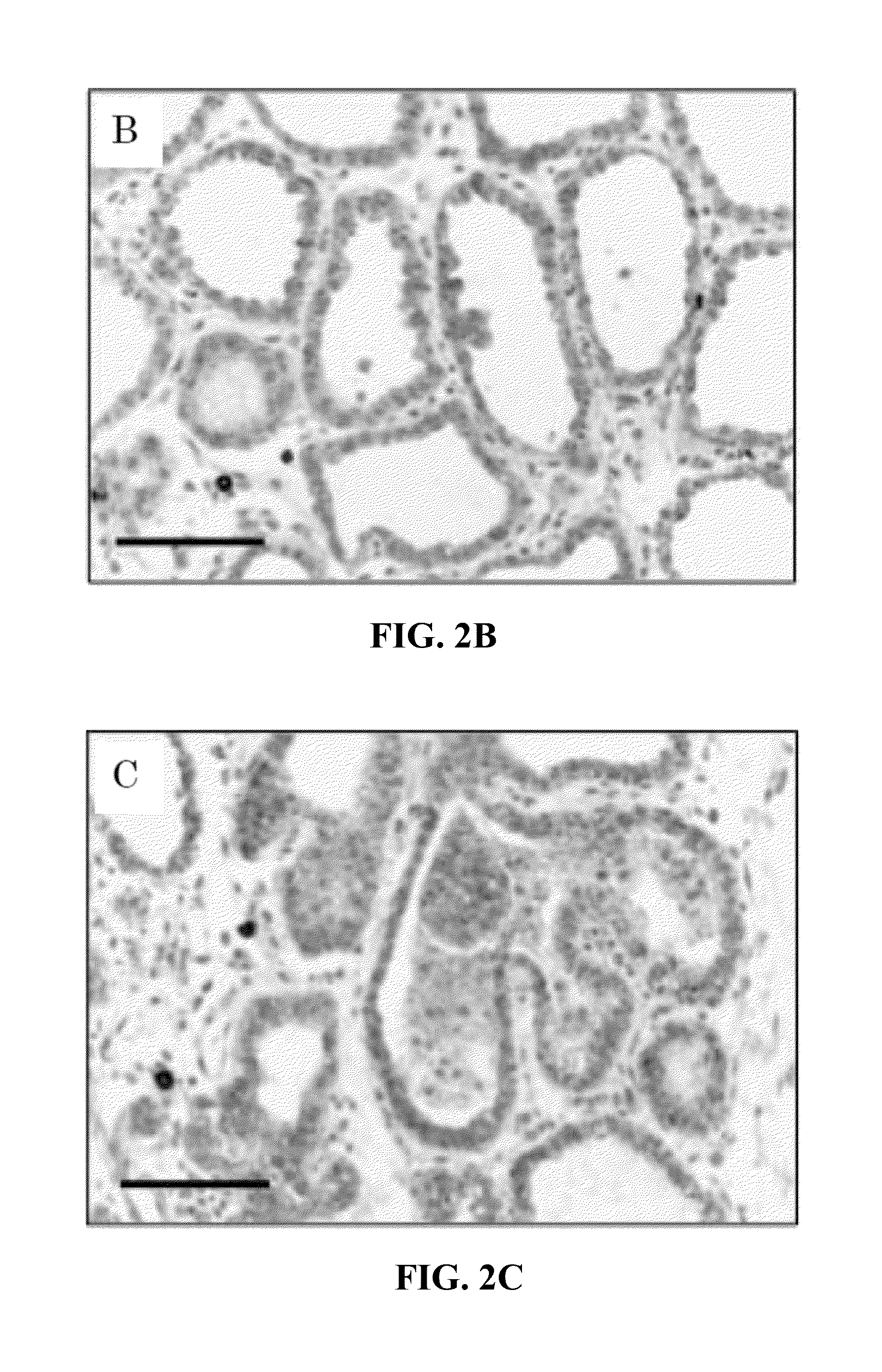 Method of examining mammary gland disease