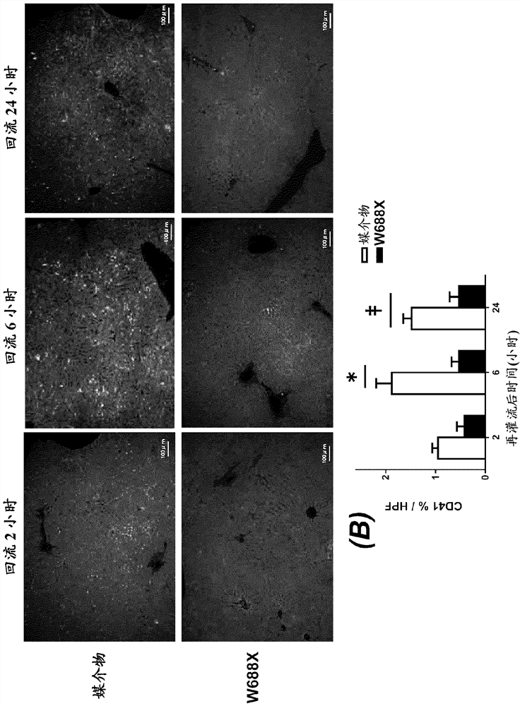 Diagnostics and pharmaceuticals containing adamts13 as a main ingredient