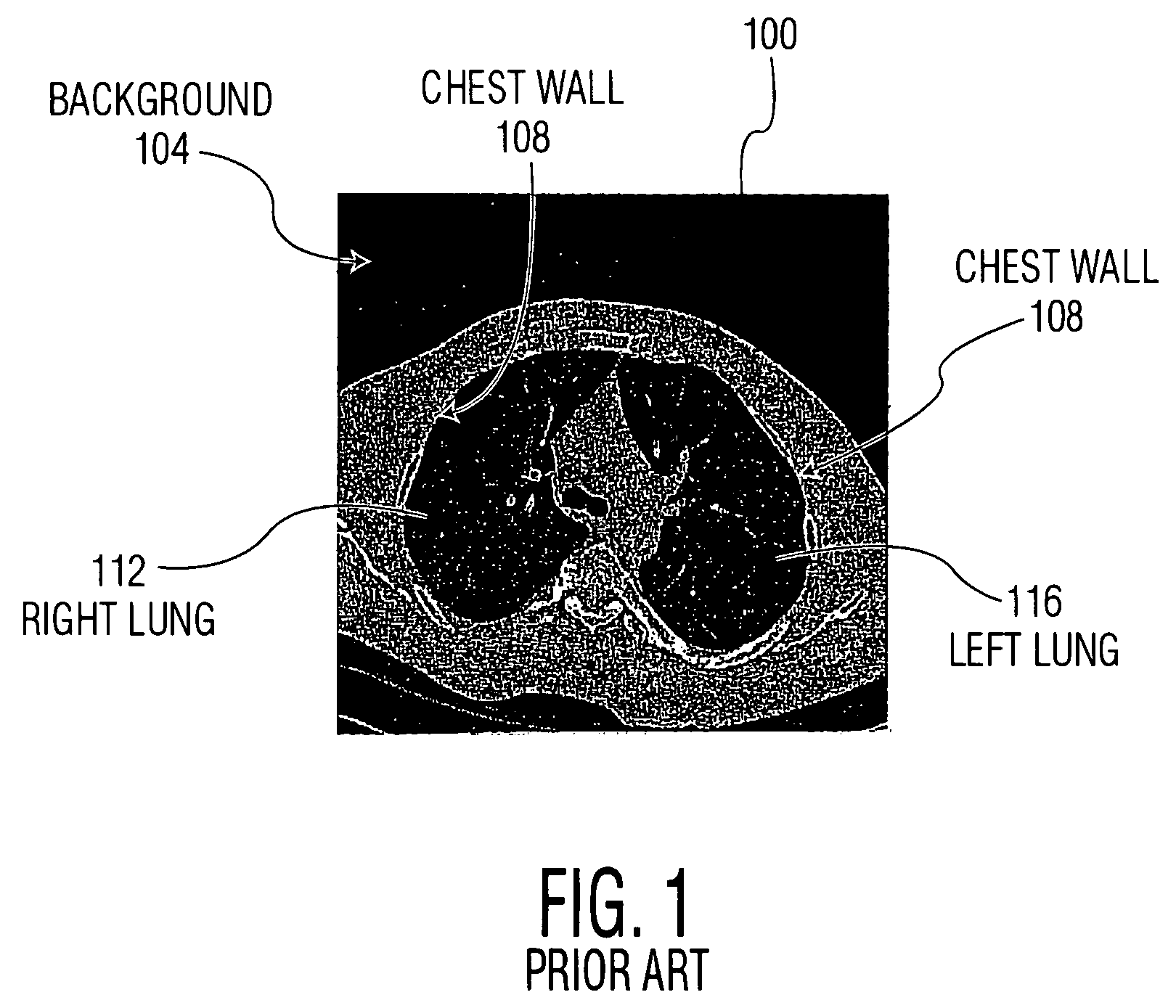 Method and system for automatic lung segmentation