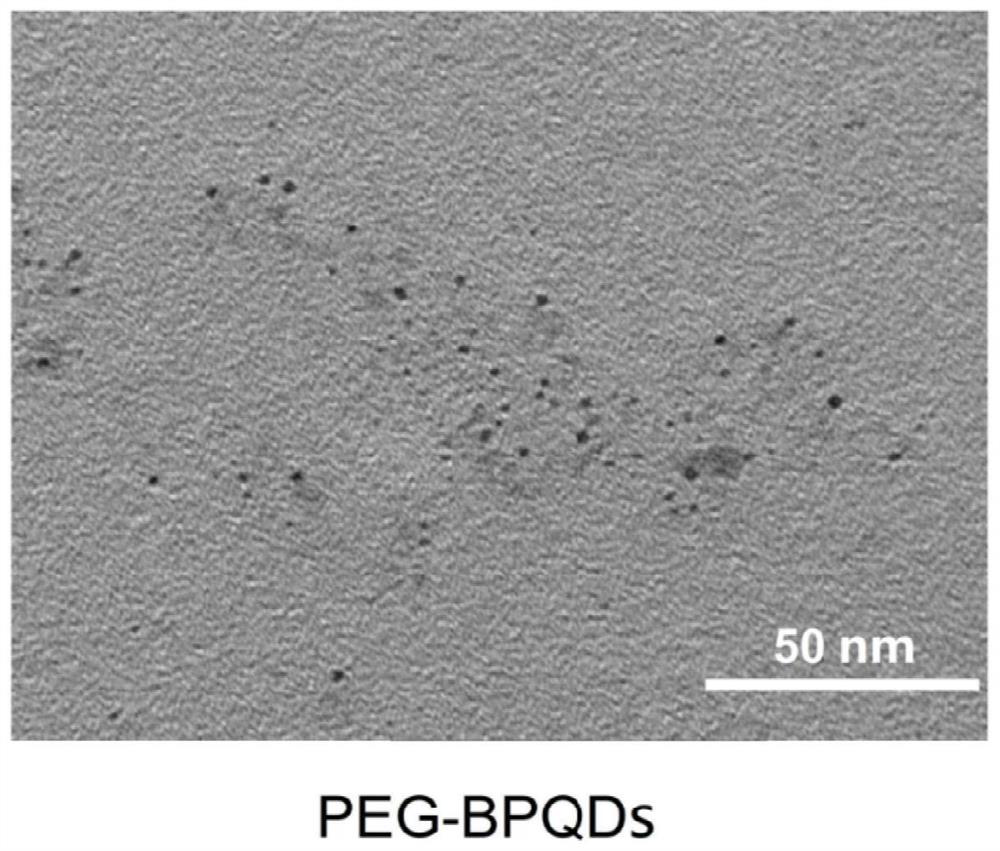 Application of PEG-modified black phosphorus quantum dots in evaluation of drug-induced acute kidney injury