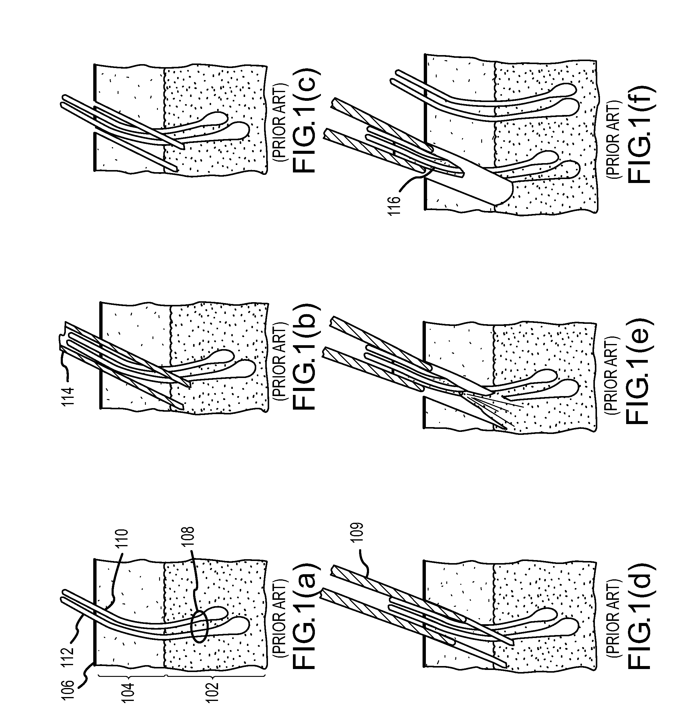 Follicular extraction method and device